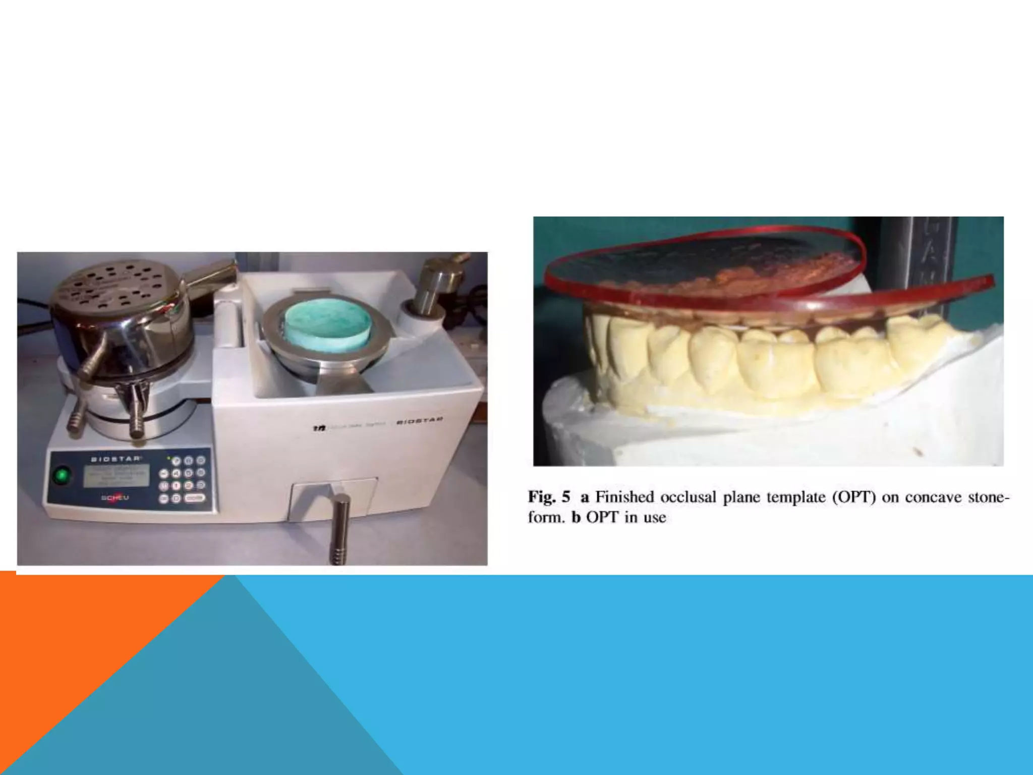Fabrication of self grinding occlusal plane template | PPTX