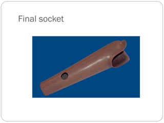 Radial Socket Spring FABRICATION OF prosthetic TRANS RADIAL SOCKET.pdf