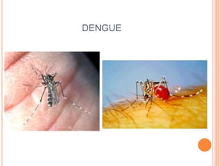 DENGUE
 