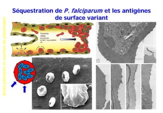 Accèspalustresetsouchesdeplasmodies
Séquestration de P. falciparum et les antigènes
de surface variant
 
