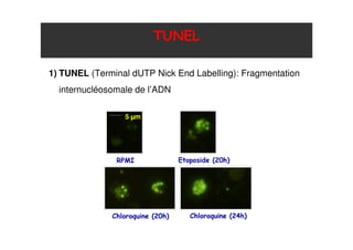 @ A
,B ?
5 µm
A ! C49 D
< C4E D< C49 D
1) TUNEL (Terminal dUTP Nick End Labelling): Fragmentation
internucléosomale de l’ADN
 