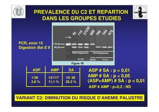 PREVALENCE DU C2 ET REPARTION
DANS LES GROUPES ETUDIES
PCR, exon 15
Digestion Bst E II
ASP AMP SA
1/39
2,6 %
13/117
11,1 %
10/ 38
26,3 %
Figure 1B
Heterozygosous Homozygosous
C1/C1C2/C2C1/C2
n. dig.
110 pb
90 pb
45
110
27230
688
189
544
875
ASP # SA : p < 0,01
AMP # SA : p < 0,05
ASP # AMP : p<0,2 ; NS
(ASP+AMP) # SA : p < 0,01
VARIANT C2: DIMINUTION DU RISQUE D’ANEMIE PALUSTRE
 