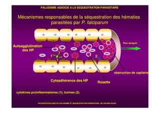 cytokines proinflammatoires (1), toxines (2).
1
Flux sanguin
6
2
Mécanismes responsables de la séquestration des hématies
parasitées par P. falciparum
PALUDISME ASSOCIE A LA SEQUESTRATION PARASITAIRE
obstruction de capilaire
Cytoadhérence des HP Rosette
Autoagglutination
des HP
1
PHYSIOPATHOLOGIE DU PALUDISME ET SEQUESTRATION PARASITAIRE: JB LEKANA-DOUKI
 