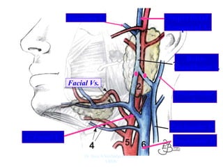 Retro-
Mandibular V.
Ext.jugular V.
Post.auricular
V.
C.Facial V.
Superficial
Temporal V.
Maxillary V.
Int.jugular V.
Facial Vs.
Dr. Siraj A Shirbadgi Professor
VBMC
 