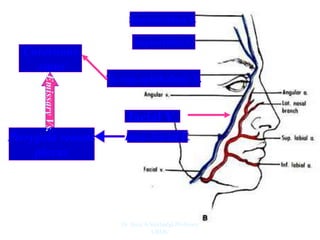 Supratrochlear V.
Supraorbital V.
facial V.
To sup.ophthalmic V.
Cavernous
sinus
Deep Facial V.
Pterygoid venous
plexus
Emissary
Vs.
Dr. Siraj A Shirbadgi Professor
VBMC
 