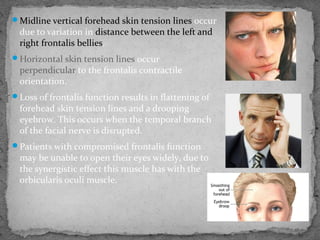 Midline vertical forehead skin tension lines occur
due to variation in distance between the left and
right frontalis bellies.
Horizontal skin tension lines occur
perpendicular to the frontalis contractile
orientation.
Loss of frontalis function results in flattening of
forehead skin tension lines and a drooping
eyebrow. This occurs when the temporal branch
of the facial nerve is disrupted.
Patients with compromised frontalis function
may be unable to open their eyes widely, due to
the synergistic effect this muscle has with the
orbicularis oculi muscle.
 