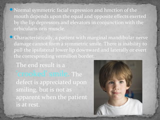Normal symmetric facial expression and hmction of the
mouth depends upon the equal and opposite effects exerted
by the lip depressors and elevators in conjunction with the
orbicularis oris muscle.
Characteristically, a patient with marginal mandibular nerve
damage cannot form a symmetric smile. There is inability to
pull the ipsilateral lower lip downward and laterally or evert
the corresponding vermilion border.
The end result is a
'crooked' smile. The
defect is appreciated upon
smiling, but is not as
apparent when the patient
is at rest.
 