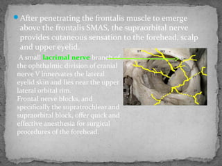 After penetrating the frontalis muscle to emerge
above the frontalis SMAS, the supraorbital nerve
provides cutaneous sensation to the forehead, scalp
and upper eyelid.
A small lacrimal nerve branch of
the ophthalmic division of cranial
nerve V innervates the lateral
eyelid skin and lies near the upper
lateral orbital rim.
Frontal nerve blocks, and
specifically the supratrochlear and
supraorbital block, offer quick and
effective anesthesia for surgical
procedures of the forehead.
 