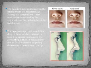 The nasalis muscle courses across the
nasal dorsum and facilitates alar
'flaring‘ and compression. These
muscles are innervated by the
zygomatic and buccal branches of the
facial nerve.
The depressor septi nasi muscle lies
deep to the orbicularis oris and can
form a transverse skin tension line
across the philtrum. It plays a minor
role in facial expression by pulling
the columella down toward the lip
 