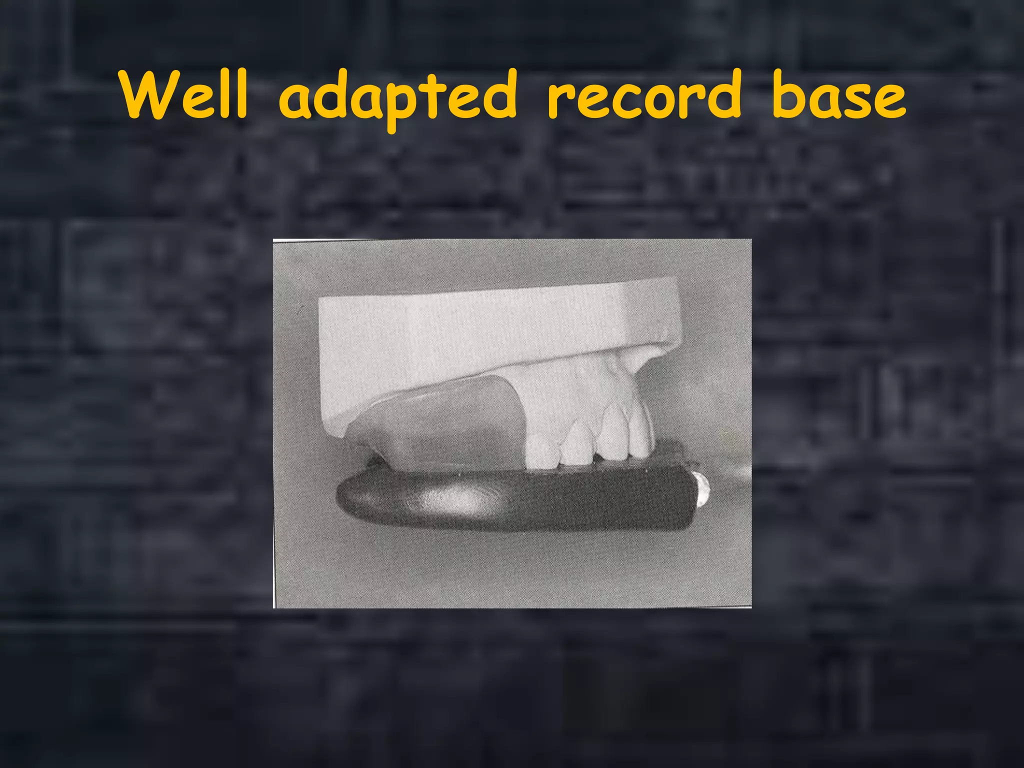 Well adapted record base
 