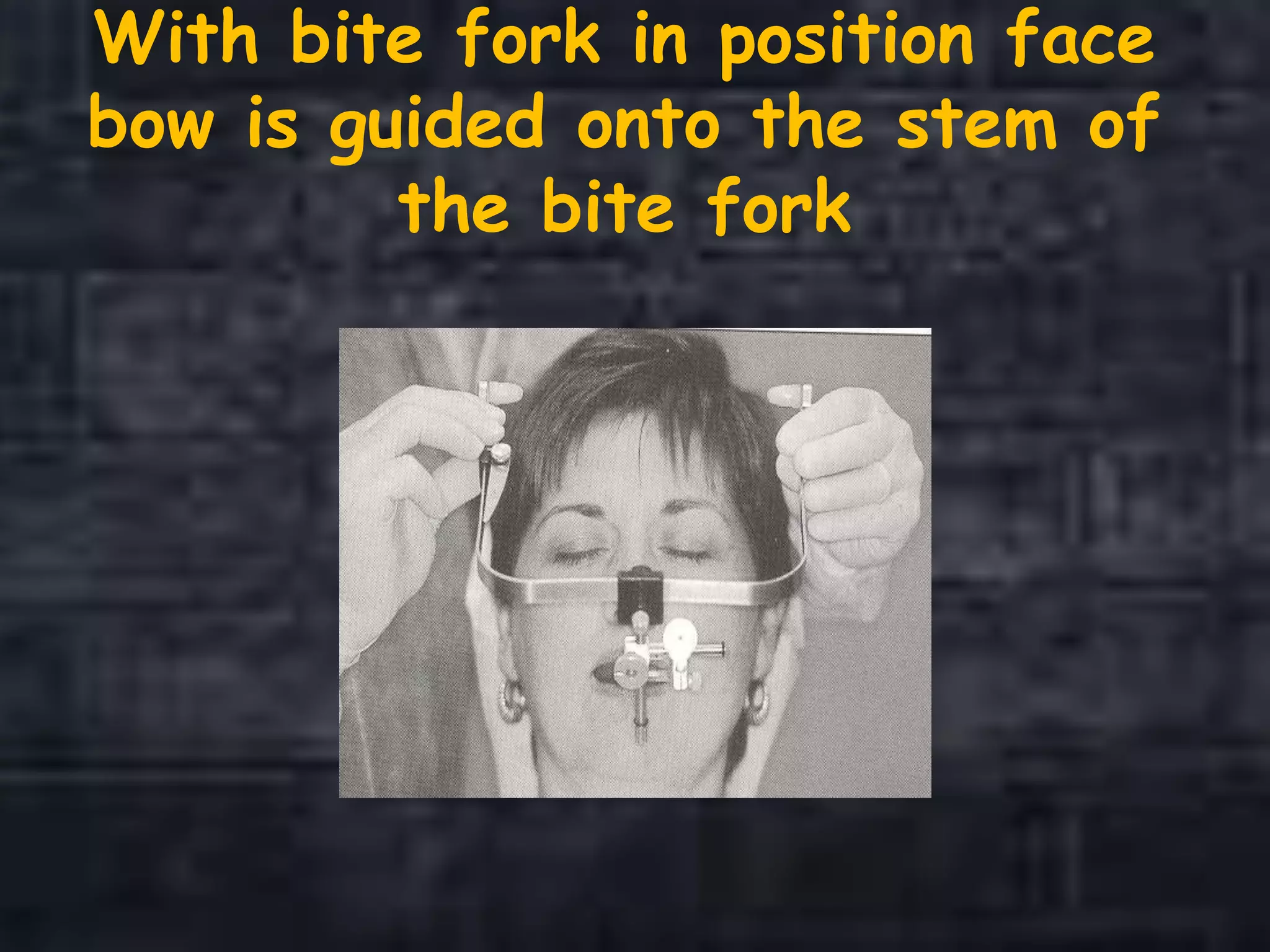 With bite fork in position face
bow is guided onto the stem of
the bite fork
 