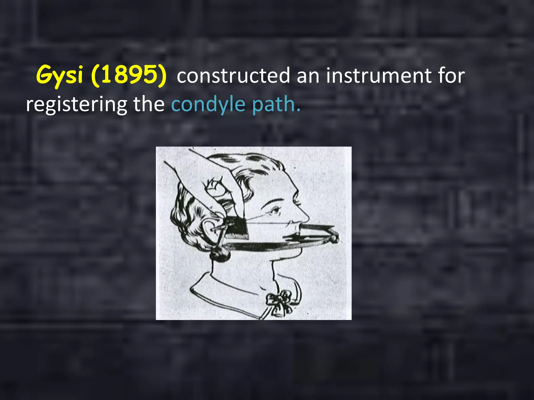 Gysi (1895) constructed an instrument for
registering the condyle path.
 