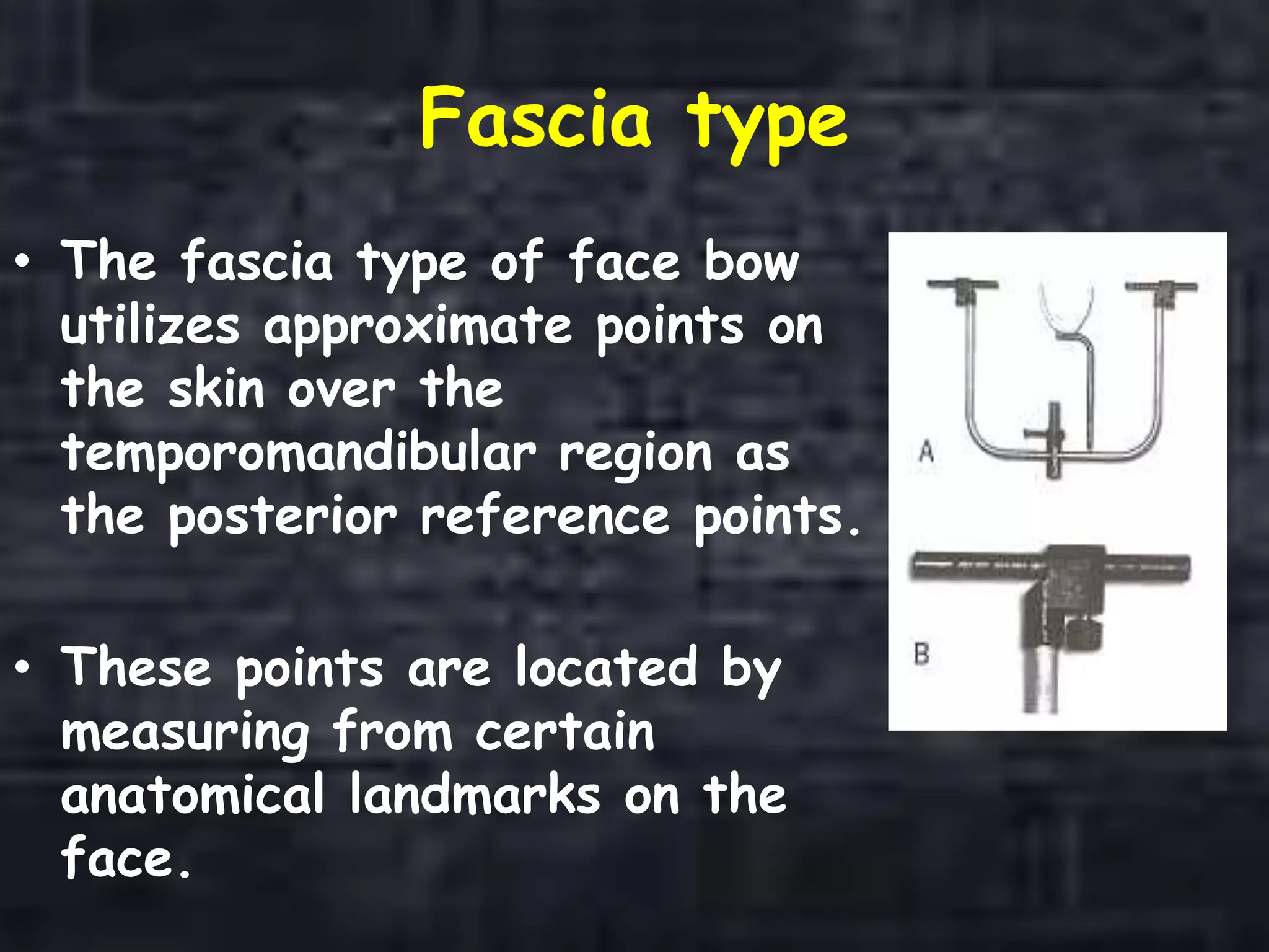 Fascia type
• The fascia type of face bow
utilizes approximate points on
the skin over the
temporomandibular region as
the posterior reference points.
• These points are located by
measuring from certain
anatomical landmarks on the
face.
 