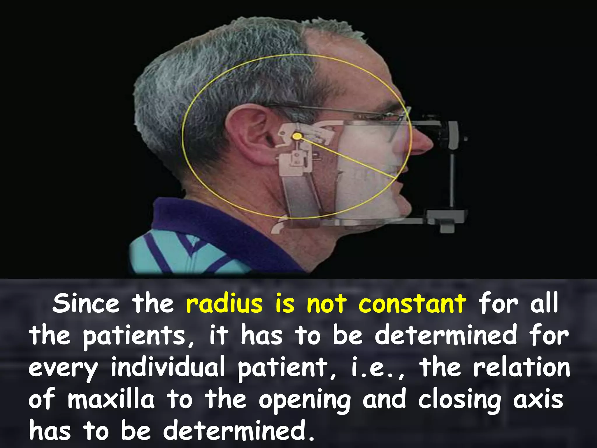 Since the radius is not constant for all
the patients, it has to be determined for
every individual patient, i.e., the relation
of maxilla to the opening and closing axis
has to be determined.
 