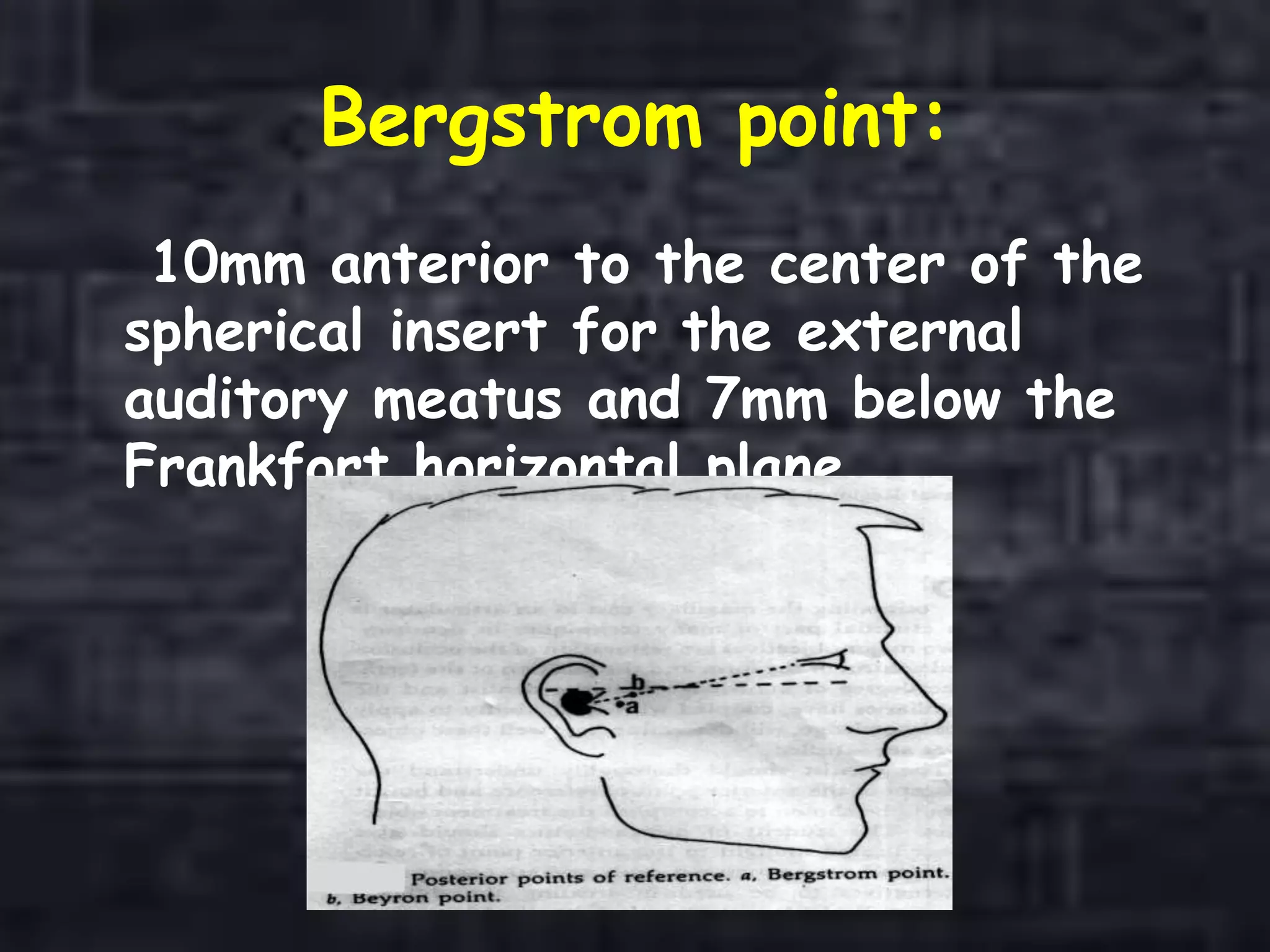 Bergstrom point:
10mm anterior to the center of the
spherical insert for the external
auditory meatus and 7mm below the
Frankfort horizontal plane.
 