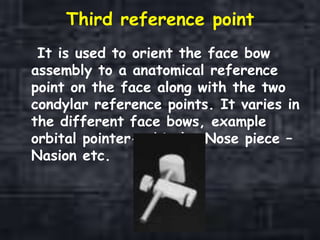 Face bow | PPTX