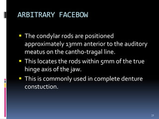 Condylar Rods Facebow | PPT