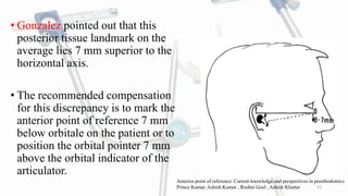 FACEBOW.pptx
