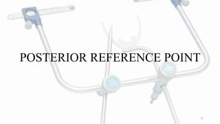 FACEBOW.pptx