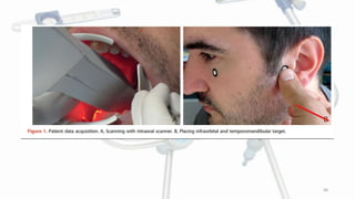 FACEBOW.pptx