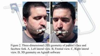 FACEBOW.pptx