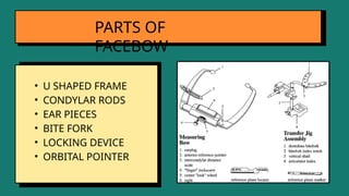 • U SHAPED FRAME
• CONDYLAR RODS
• EAR PIECES
• BITE FORK
• LOCKING DEVICE
• ORBITAL POINTER
PARTS OF
FACEBOW
 
