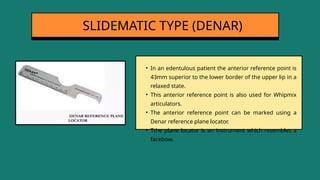 • In an edentulous patient the anterior reference point is
43mm superior to the lower border of the upper lip in a
relaxed state.
• This anterior reference point is also used for Whipmix
articulators.
• The anterior reference point can be marked using a
Denar reference plane locator.
• Tthe plane locator is an instrument which resembles a
facebow.
SLIDEMATIC TYPE (DENAR)
 