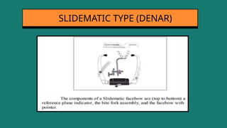 SLIDEMATIC TYPE (DENAR)
 