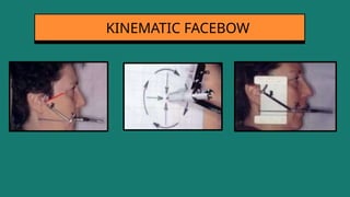 KINEMATIC FACEBOW
 