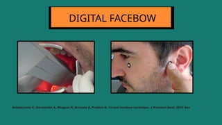 DIGITAL FACEBOW
Solaberrieta E, Garmendia A, Minguez R, Brizuela A, Pradies G. Virtual facebow technique. J Prosthet Dent. 2015 Dec
 