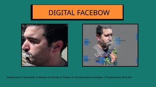 DIGITAL FACEBOW
Solaberrieta E, Garmendia A, Minguez R, Brizuela A, Pradies G. Virtual facebow technique. J Prosthet Dent. 2015 Dec
 