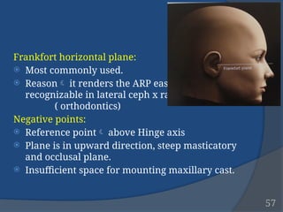 FACE BOWS AND ARTICULATORS IN Fixed dental prosthesis | PPTX