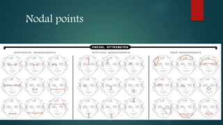 Nodal points
 