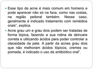  Esse tipo de acne é mais comum em homens e
pode aparecer não só na face, como nas costas,
na região peitoral também. Nesse caso,
geralmente é indicado tratamento com remédios
orais”, explica.
 Acne grau um e grau dois podem ser tratadas de
forma tópica, fazendo a sua rotina de skincare
correta e utilizando ácidos para poder controlar a
oleosidade da pele. A partir da acnes grau dois
que não melhoram ácidos tópicos, cremes ou
pomada, é indicado o uso de antibiótico oral”.
 