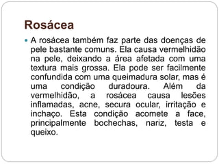 Rosácea
 A rosácea também faz parte das doenças de
pele bastante comuns. Ela causa vermelhidão
na pele, deixando a área afetada com uma
textura mais grossa. Ela pode ser facilmente
confundida com uma queimadura solar, mas é
uma condição duradoura. Além da
vermelhidão, a rosácea causa lesões
inflamadas, acne, secura ocular, irritação e
inchaço. Esta condição acomete a face,
principalmente bochechas, nariz, testa e
queixo.
 