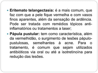  Eritemato telangectasia: é a mais comum, que
faz com que a pele fique vermelha e com vasos
finos aparentes, além da sensação de ardência.
Pode ser tratada com remédios tópicos anti-
inflamatórios ou tratamentos a laser;
 Pápula pustular: tem como característica, além
da vermelhidão, o surgimento de lesões pápulo-
pustulosas, semelhantes à acne. Para o
tratamento, é comum que sejam utilizados
antibióticos via oral ou até a isotretinoína para
redução das lesões.
 