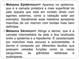  Melasma Epidérmico=> Aparece na epiderme,
que é a camada protetora e mais superficial da
pele (aquela que está em contato direto com
agentes externos, como a radiação solar por
exemplo). Geralmente esse melasma apresenta
manchas de cor marrom com bordas mais bem
definidas.
 Melasma Dérmico=> Atinge a derme, que é a
camada intermediária da pele e fica localizada
entre a epiderme e a hipoderme. É caracterizado
por manchas mais escuras e acinzentadas. A
derme é composta por diferentes tecidos que
possuem variadas funções como os vasos
sanguíneos, as glândulas sebáceas e
sudoríparas.
 