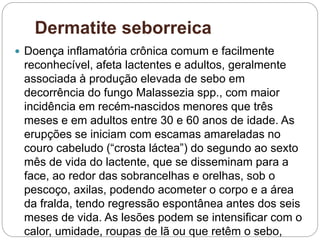 Dermatite seborreica
 Doença inflamatória crônica comum e facilmente
reconhecível, afeta lactentes e adultos, geralmente
associada à produção elevada de sebo em
decorrência do fungo Malassezia spp., com maior
incidência em recém-nascidos menores que três
meses e em adultos entre 30 e 60 anos de idade. As
erupções se iniciam com escamas amareladas no
couro cabeludo (“crosta láctea”) do segundo ao sexto
mês de vida do lactente, que se disseminam para a
face, ao redor das sobrancelhas e orelhas, sob o
pescoço, axilas, podendo acometer o corpo e a área
da fralda, tendo regressão espontânea antes dos seis
meses de vida. As lesões podem se intensificar com o
calor, umidade, roupas de lã ou que retêm o sebo,
 