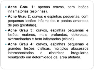  Acne Grau 1: apenas cravos, sem lesões
inflamatórias (espinhas).
 Acne Grau 2: cravos e espinhas pequenas, com
pequenas lesões inflamadas e pontos amarelos
de pus (pústulas).
 Acne Grau 3: cravos, espinhas pequenas e
lesões maiores, mais profundas, dolorosas,
avermelhadas e bem inflamadas (cistos).
 Acne Grau 4: cravos, espinhas pequenas e
grandes lesões císticas, múltiplos abscessos
interconectados e cicatrizes irregulares
resultando em deformidade da área afetada.
 