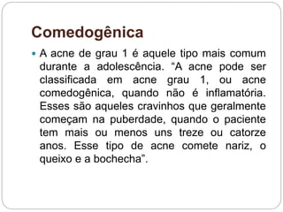 Comedogênica
 A acne de grau 1 é aquele tipo mais comum
durante a adolescência. “A acne pode ser
classificada em acne grau 1, ou acne
comedogênica, quando não é inflamatória.
Esses são aqueles cravinhos que geralmente
começam na puberdade, quando o paciente
tem mais ou menos uns treze ou catorze
anos. Esse tipo de acne comete nariz, o
queixo e a bochecha”.
 