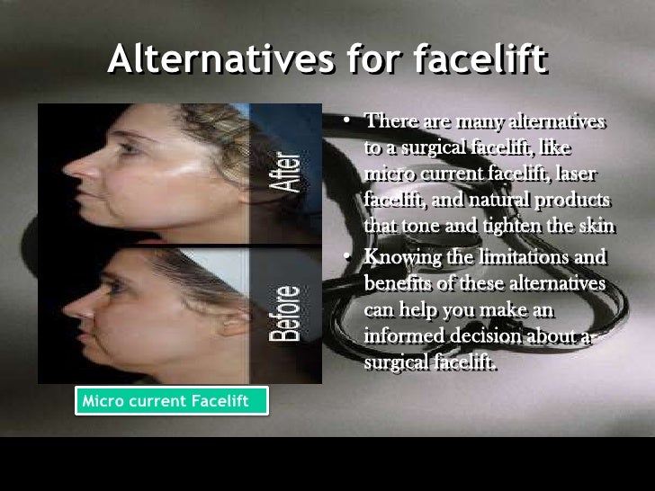 Facelift in Mexico, Cancun & Tijuana Best facelift treatment