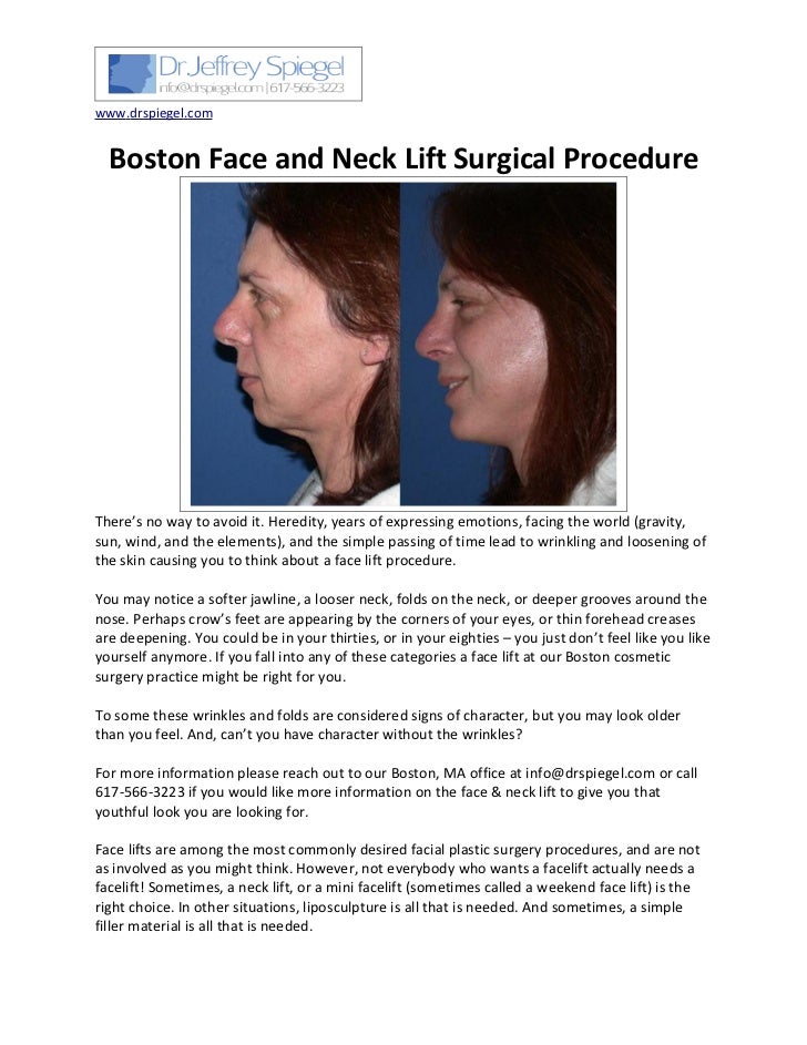 Boston Face and Neck Lift Surgical Procedure