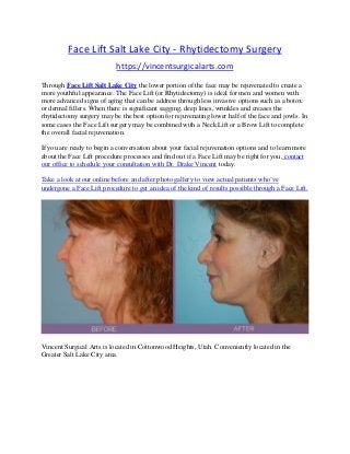 Face Lift Salt Lake City - Rhytidectomy Surgery
https://vincentsurgicalarts.com
Through Face Lift Salt Lake City the lower portion of the face may be rejuvenated to create a
more youthful appearance. The Face Lift (or Rhytidectomy) is ideal for men and women with
more advanced signs of aging that can be address through less invasive options such as a botox
or dermal fillers. When there is significant sagging, deep lines, wrinkles and creases the
rhytidectomy surgery may be the best option for rejuvenating lower half of the face and jowls. In
some cases the Face Lift surgery may be combined with a Neck Lift or a Brow Lift to complete
the overall facial rejuvenation.
If you are ready to begin a conversation about your facial rejuvenation options and to learn more
about the Face Lift procedure processes and find out if a Face Lift may be right for you, contact
our office to schedule your consultation with Dr. Drake Vincent today.
Take a look at our online before and after photo gallery to view actual patients who’ve
undergone a Face Lift procedure to get an idea of the kind of results possible through a Face Lift.
Vincent Surgical Arts is located in Cottonwood Heights, Utah. Conveniently located in the
Greater Salt Lake City area.
 