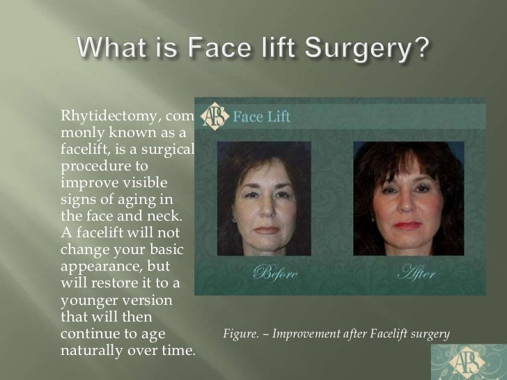 Facelift Kansas city