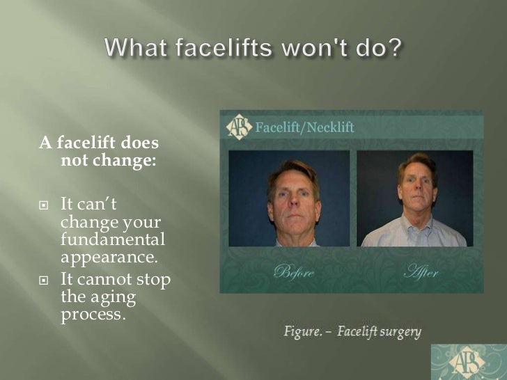 Facelift Kansas city