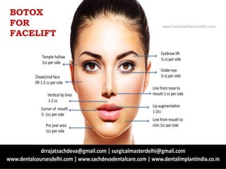 BOTOX
FOR
FACELIFT
www.facialaestheticsdelhi.com
 
