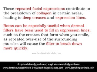 These repeated facial expressions contribute to
the breakdown of collagen in certain areas,
leading to deep creases and expression lines.
Botox can be especially useful when dermal
fillers have been used to fill in expression lines,
such as the creases that form when you smile,
as repeated over-use of the surrounding
muscles will cause the filler to break down
more quickly.
www.facialaestheticsdelhi.com
 