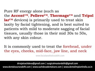 Pure RF energy alone (such as
the Accent™, Pelleve™, Thermage™ and Tripol
lar™ devices) is primarily used to treat skin
laxity by facial tightening, and is best suited to
patients with mild to moderate sagging of facial
tissues, usually those in their mid 30s to 50s,
with any skin colour.
It is commonly used to treat the forehead, under
the eyes, cheeks, mid-face, jaw line, and neck
www.facialaestheticsdelhi.com
 