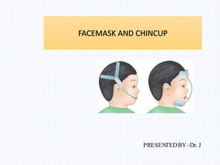 PRESENTEDBY–Dr. J
FACEMASK AND CHINCUP
 