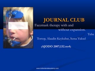 JOURNAL CLUB
Facemask therapy with and
without expansion.
Tuba
Tortop, Alaadin Keykubat, Sema Yuksel
(AJODO 2007;132.no4)
www.indiandentalacademy.com
 